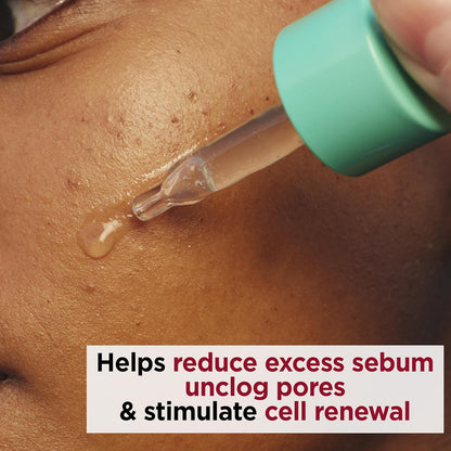 Suero Facial My Clarins Pure-Reset Resurfacing Blemish Serum - 30Ml - Mujer