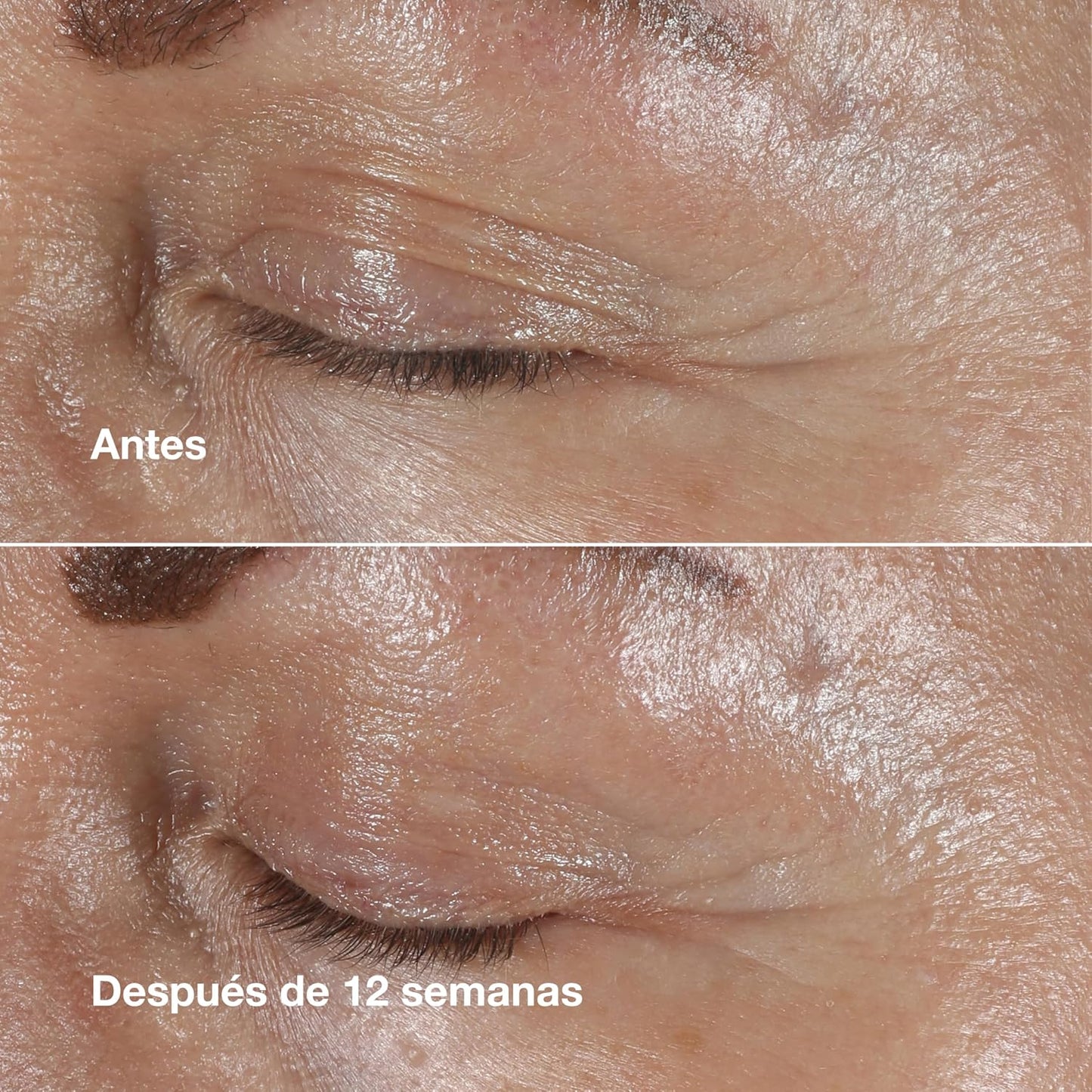 Crema Para Ojos Smart Clinical Repair Wrinkle Correcting Eye Cream - 15Ml