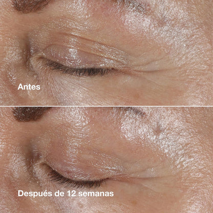 Crema Para Ojos Smart Clinical Repair Wrinkle Correcting Eye Cream - 15Ml
